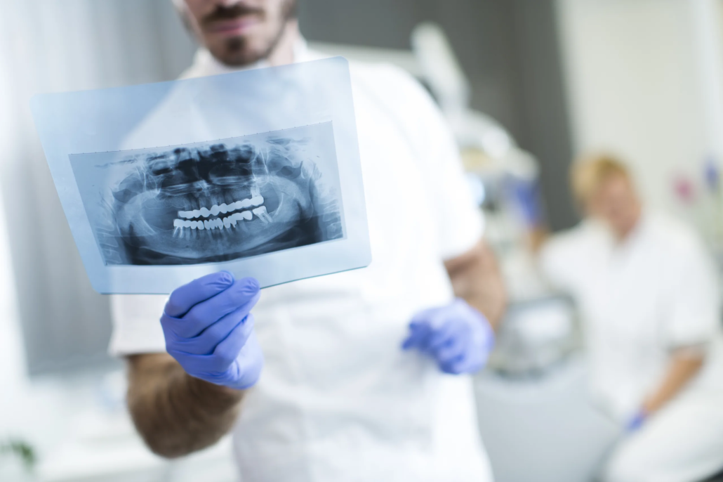 Radiographie dentaire tenue par des mains gantées Radiographie dentaire tenue par des mains gantées